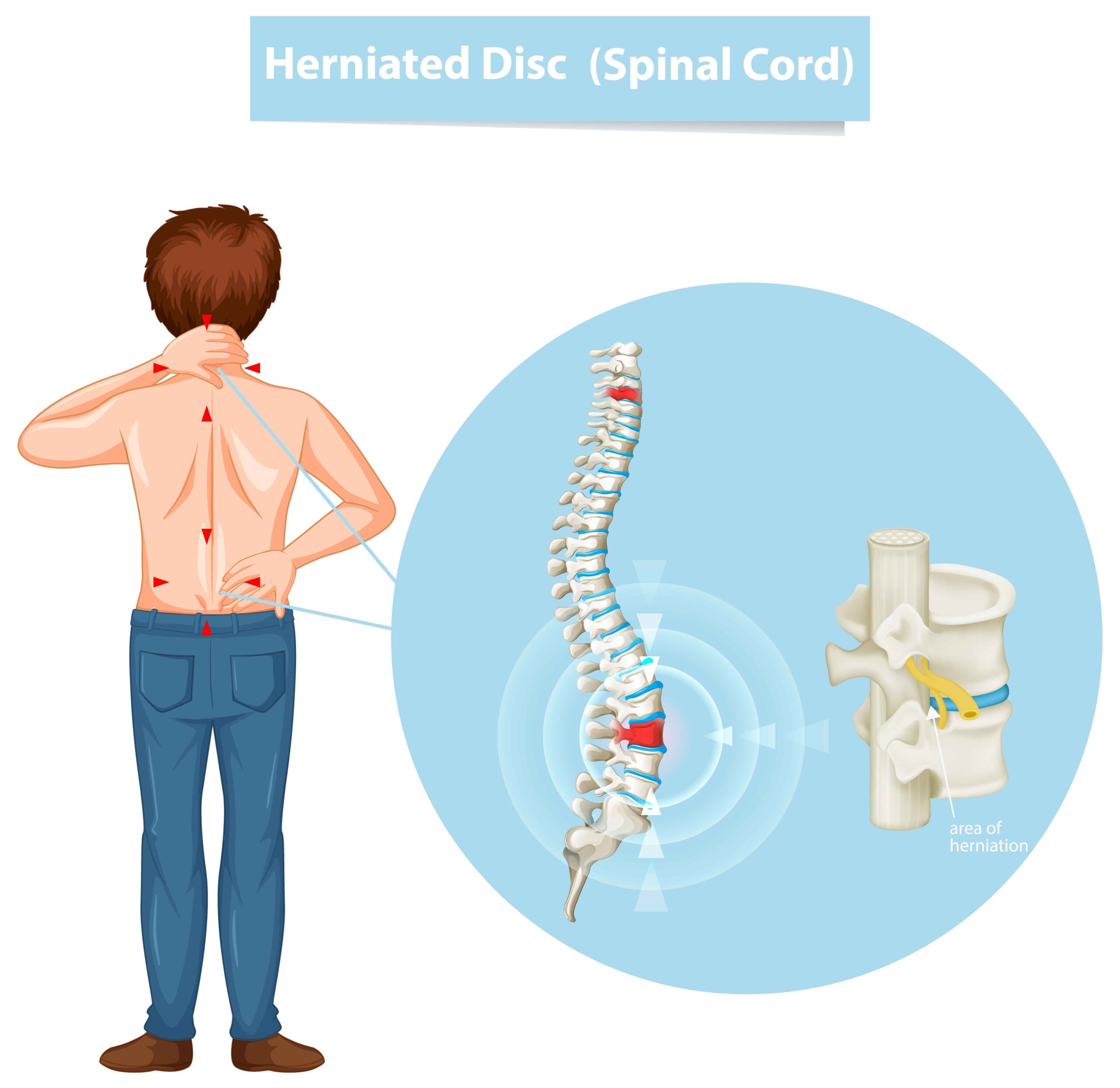 Comparing Traditional Spine Surgery to Endoscopic Techniques: What Patients Need to Know