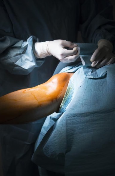 Total Knee Replacement