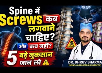 When are spinal screws necessary?