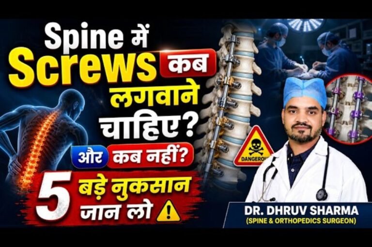 When are spinal screws necessary?